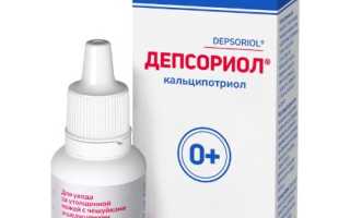 Быстрое избавление от псориаза на голове при помощи лосьона: эффективные методы и советы