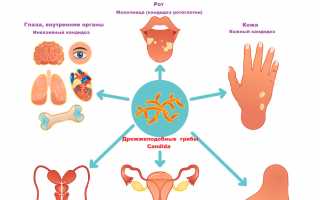 Как и почему в моче может развиться грибок? Узнайте больше о причинах