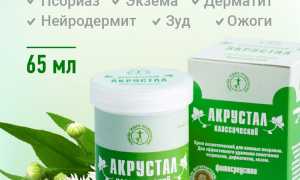 Использование крема Акрустал для лечения псориаза: эффективные методы и рекомендации