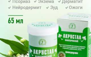 Использование крема Акрустал для лечения псориаза: эффективные методы и рекомендации