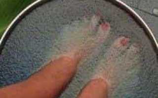 Лечение грибка ногтей на ногах с помощью ванночек в домашних условиях