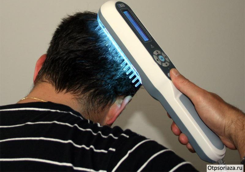 Физиотерапия при псориазе Физиотерапия при псориазе