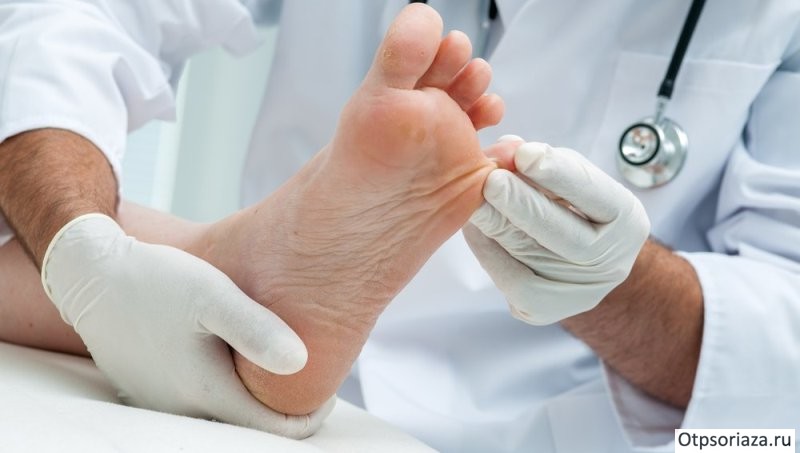 Осмотр ногтей у дерматолога Осмотр ногтей у дерматолога