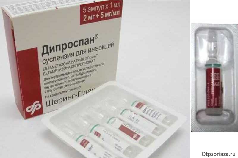Дипроспан Дипроспан