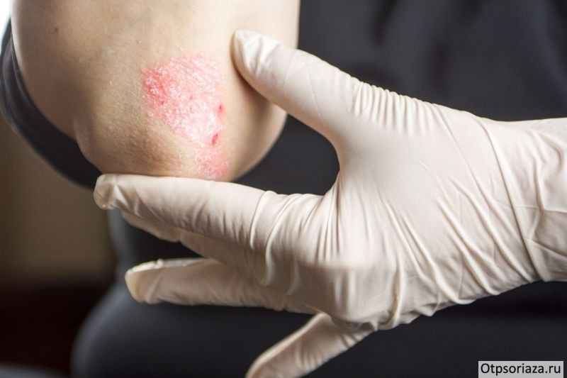 кровяная роса Кровяная роса