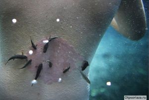 Бассейн с рыбами гарра руфа для лечения псориаза Лечение псориаза рыбками гарра руфа