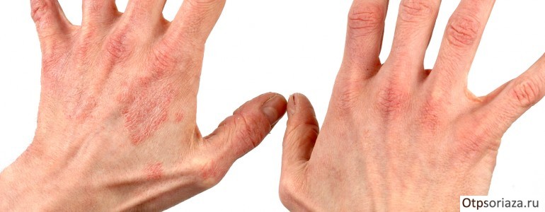 Советы по применению мазей Советы по применению