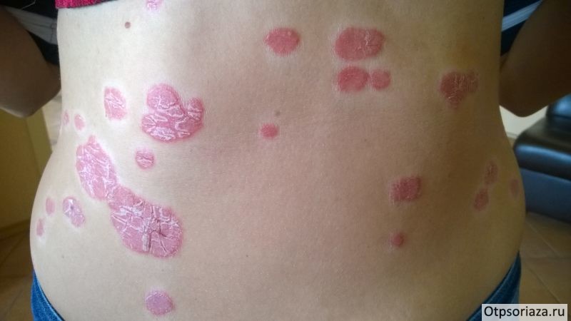 стеариновое пятно Стеариновое пятно